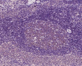 PIBF1 Rabbit Polyclonal Antibody