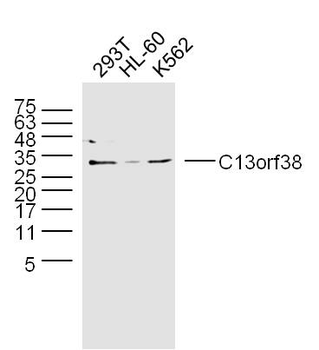 C13orf38 Rabbit Polyclonal Antibody