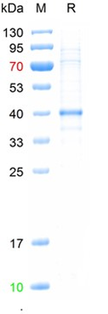 Recombinant human ANO1 protein, His