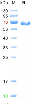 Recombinant human RCBTB2 protein, His