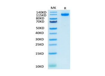 Recombinant human VEGFR1 protein, C-His-Avi (HEK293)