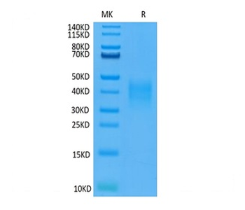 Recombinant human TNFRSF10D protein, C-His-Avi (HEK293)
