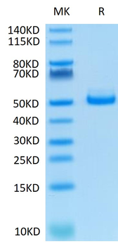 Recombinant human TIGIT protein, C-hFc (HEK293)