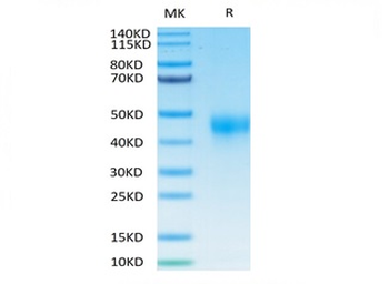 Recombinant human TFPI protein, C-His-Avi (HEK293)