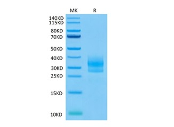 Recombinant human Sclerostin, N-His-Avi (HEK293)