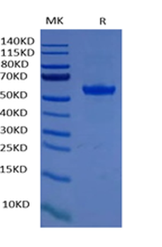 Recombinant human ROR2 protein, C-His-Avi (HEK293)