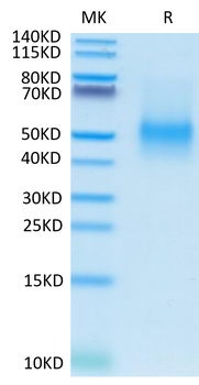 Recombinant mouse PD-L1 protein, C-His (HEK293)