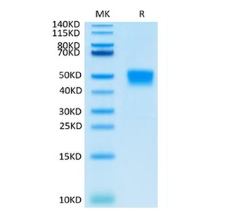 Recombinant mouse Mesothelin / MSLN protein, C-His (HEK293)