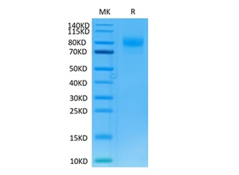 Recombinant human IL-13RA1 protein, C-hFc (HEK293)