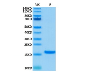 Recombinant human IL-21 protein (HEK293)