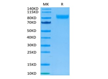 Recombinant human IL-17RA protein, C-hFc-Avi (HEK293)