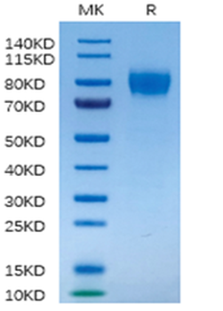 Recombinant human IFN-Alpha / Beta R1 protein, C-His-Avi (HEK293)