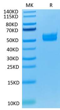 Recombinant human ICOS protein, C-hFc (HEK293)