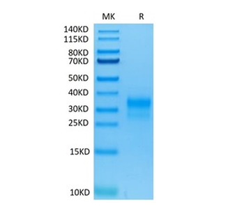 Recombinant human ErbB2 / Her2 (Domain IV) protein, C-His-Avi (HEK293)