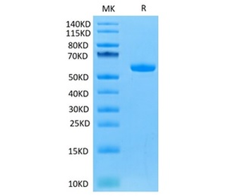 Recombinant human FGF21 protein, N-mFc-Avi (HEK293)