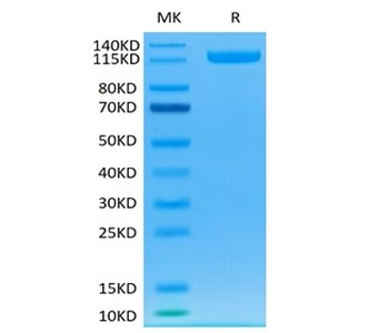 Recombinant human DPP4/CD26 protein, N-hFc (HEK293)
