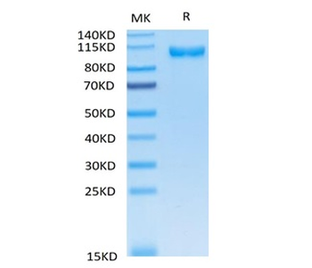 Recombinant human DPP4/CD26 protein, C-His (HEK293)
