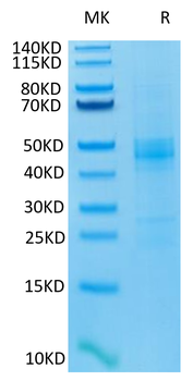 Recombinant human CTGF / CCN2 protein, C-His-Avi (HEK293)