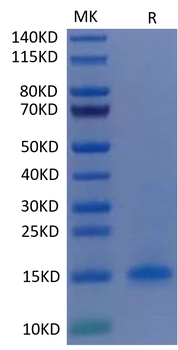 Recombinant human CD3D protein, C-His (HEK293)