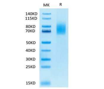 Recombinant human CD30 protein, C-His-Avi (HEK293)