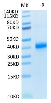 Recombinant human CD2 protein, C-His (HEK293)