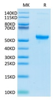 Recombinant human CA9 protein, C-His-Avi (HEK293)