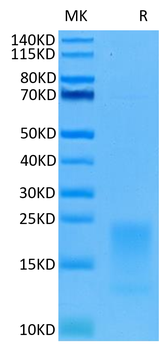 Recombinant human BAFFR protein, C-His (HEK293)