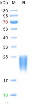 Recombinant human CD90 (THY1) protein, C-His (HEK293)