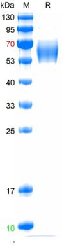 Recombinant human AMH protein, C-His (HEK293)
