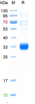Recombinant human Adiponectin, C-His Tag (HEK293)