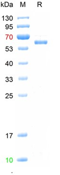 Recombinant human LAG3 protein, C-His (HEK293)