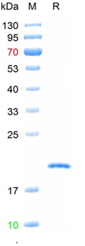 Recombinant human IL-10 protein, His (HEK293)
