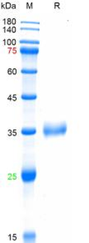Recombinant SARS-Cov-2 Spike RBD protein (K417N, L452R,T478K), His (HEK293)