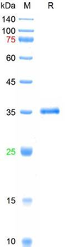 Recombinant SARS-Cov-2 Spike RBD protein (K417N, L452R,T478K), His (HEK293)
