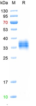Recombinant human SIGLEC15 protein, His (HEK293)