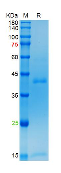 Recombinant human Inhibin Beta B protein, His (HEK293)