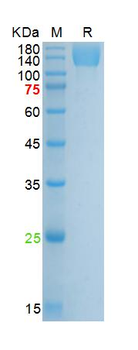 Recombinant human VEGFR2 protein, His (HEK293)