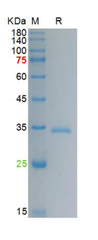 Recombinant human IGFBP1 protein, His (HEK293)