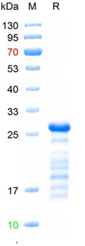 Recombinant human SLC12A3 protein, N-His