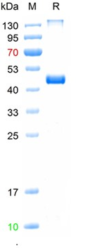 Recombinant human ESR2 protein, His
