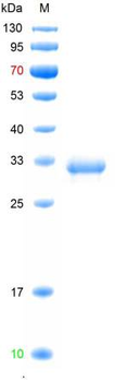 Recombinant human Cytoglobin, His