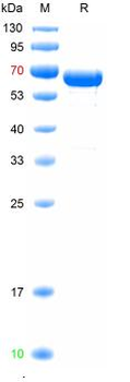 Recombinant human Peripherin, His