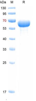Recombinant human Vimentin, N-His