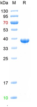 Recombinant human THRB protein, N-His Tag
