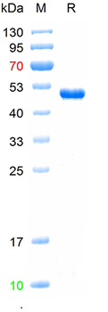 Recombinant SARS-Cov-2 (Omicron, B.1.1.529) N protein (P13L, E31del, R32del, S33del, R203K, G204R), N-His