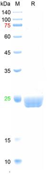 Recombinant hepatitis B virus e virus like particle protein, His