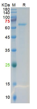 Recombinant SARS-Cov-2 Spike S1 protein, His