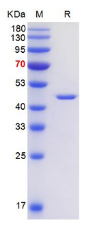 Recombinant PCV2 Cap protein, Trx & His