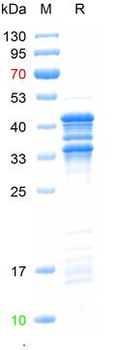 Recombinant human SGK3 protein
