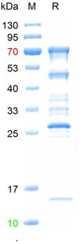 Recombinant human Beta galactosidase protein